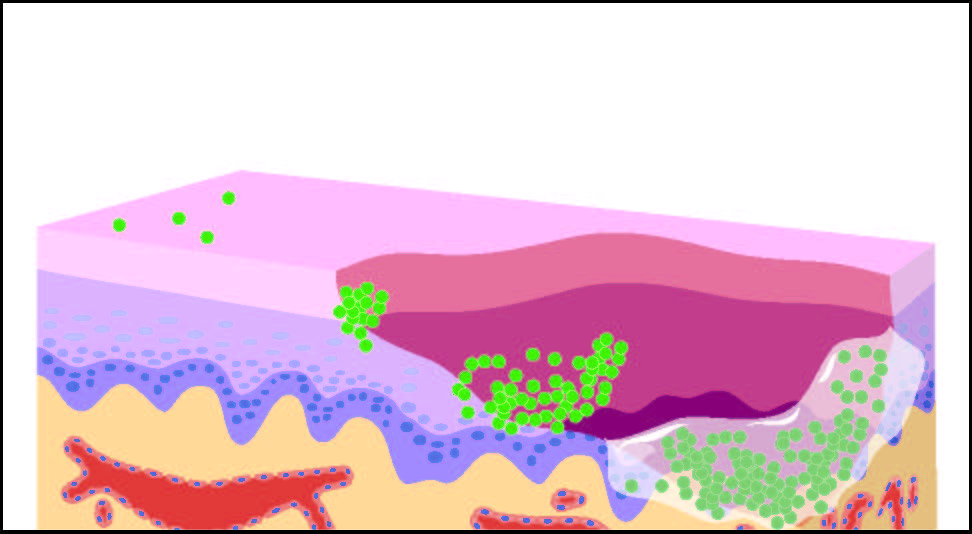 The Bacterial Biofilm